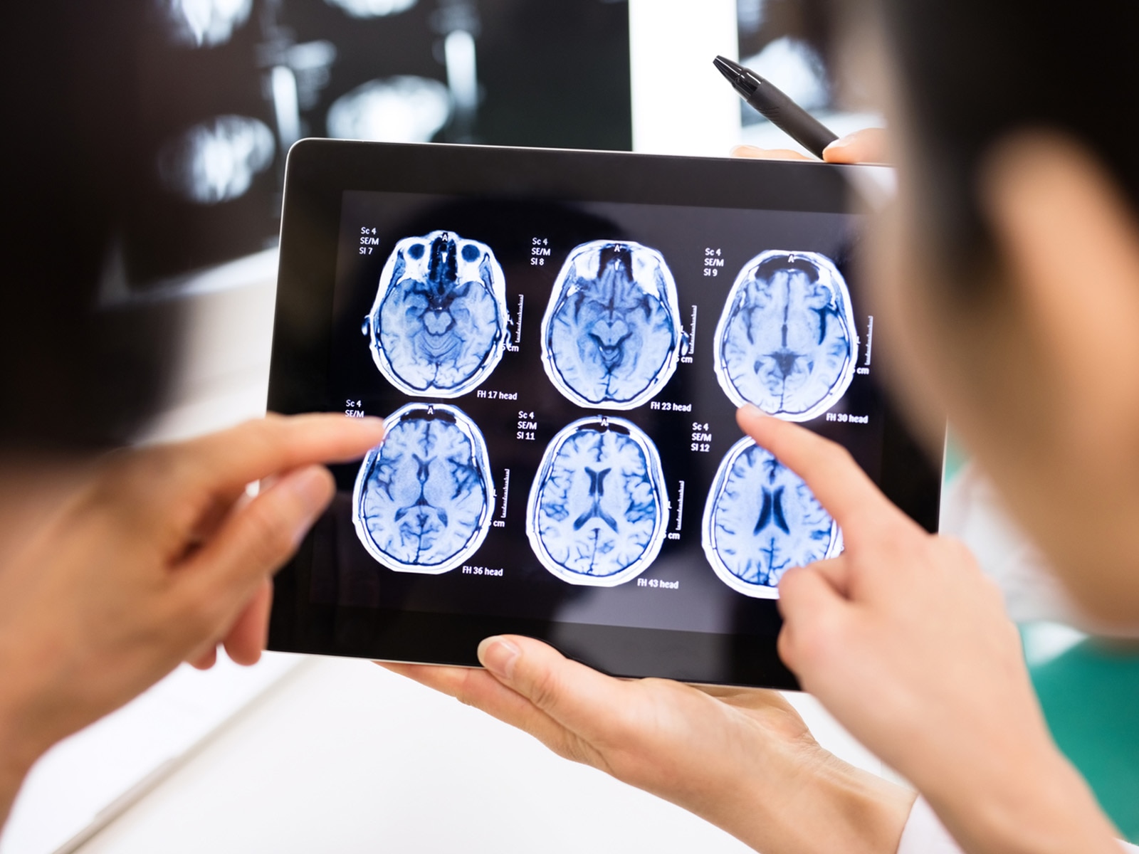 People looking at brain scans on a tablet.